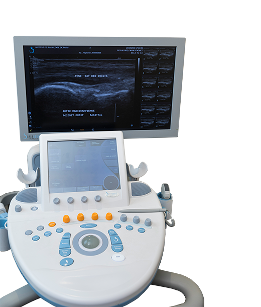 Echographie Doppler - examen d'imagerie l Institut de radiologie de Paris